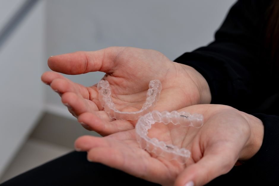 Invisible Aligners vs Traditional Braces Compared