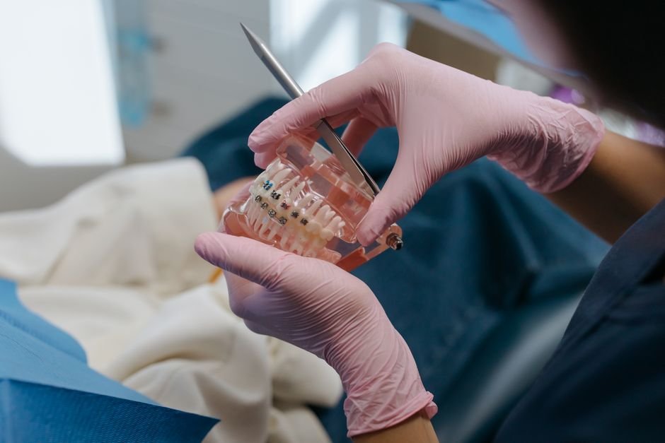 Understanding Orthodontic Relapse and How to Prevent It